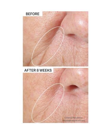 Shop StriVectin Peptight Tightening & Brightening Face Serum - 1.7 oz/ 50 mL Online - Best Price & International Shipping - Buy Online on GoSupps.com