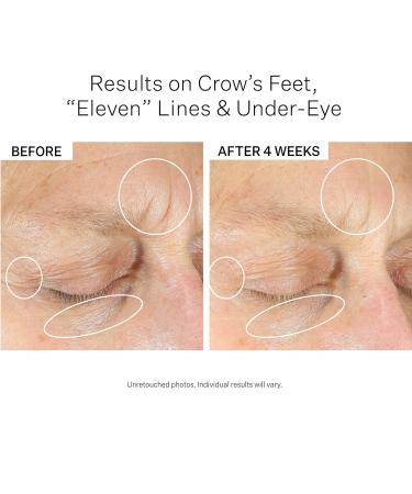 Shop StriVectin Intensive Eye Cream Concentrate for Wrinkles PLUS - 1 oz / 30 mL Online - Best Price & International Shipping - Buy Online on GoSupps.com