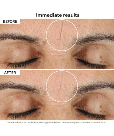 Shop StriVectin Line BlurFector Instant Wrinkle Blurring Face Primer - 1 oz / 30 mL Online - Best Price & International Shipping - Buy Online on GoSupps.com