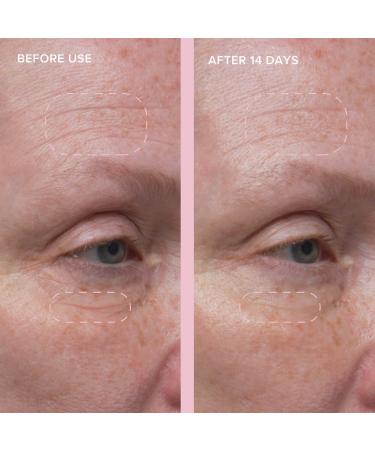 Shop Alpyn Beauty Wild Nettle & Niacinamide Instant Firming Serum - 1 oz/ 30 mL Online - Best Price & International Shipping - Buy Online on GoSupps.com