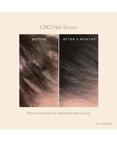 Shop Vegamour GRO Hair Serum for Thinning Hair - 1 oz / 30 mL Online - Best Price & International Shipping - Buy Online on GoSupps.com