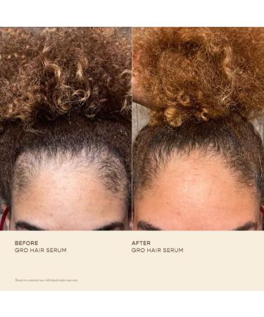 Shop Vegamour GRO Hair Serum for Thinning Hair - 1 oz / 30 mL Online - Best Price & International Shipping - Buy Online on GoSupps.com
