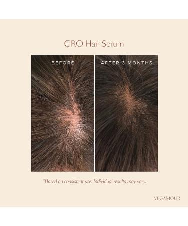 Shop Vegamour GRO Hair Serum for Thinning Hair - 1 oz / 30 mL Online - Best Price & International Shipping - Buy Online on GoSupps.com