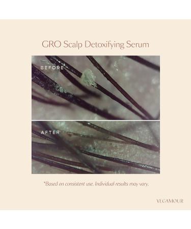 Shop Vegamour GRO Scalp Detox Clarifying Treatment for Dry Flaky Oily Scalp - 2 oz/ 60 mL Online - Best Price & International Shipping - Buy Online on GoSupps.com