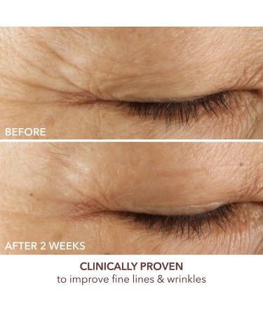 Shop Dr. Dennis Gross Skincare Advanced Retinol + Ferulic Triple Correction Eye Serum - 0.5 oz/ 15 mL Online - Best Price & International Shipping - Buy Online on GoSupps.com
