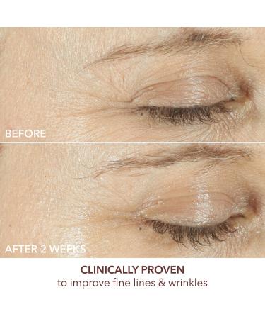 Shop Dr. Dennis Gross Skincare Advanced Retinol + Ferulic Triple Correction Eye Serum - 0.5 oz/ 15 mL Online - Best Price & International Shipping - Buy Online on GoSupps.com