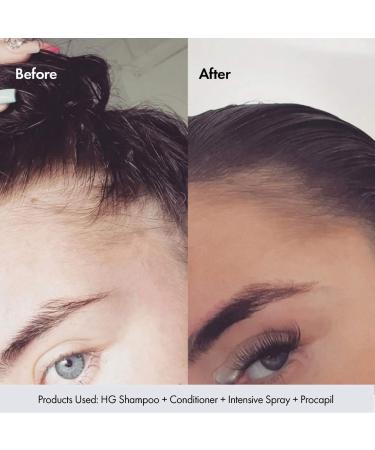 Shop BondiBoost Procapil Hair & Scalp Tonic for Thinning Hair with Horsetail Extract - 4.23 oz/ 125 mL Online - Best Price & International Shipping - Buy Online on GoSupps.com