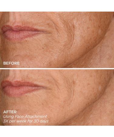 Shop BeautyBio Get That Glow - GloPRO Microneedling Tool & Discovery Set Online - Best Price & International Shipping - Buy Online on GoSupps.com
