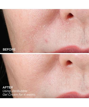 Shop BeautyBio Get That Glow - GloPRO Microneedling Tool & Discovery Set Online - Best Price & International Shipping - Buy Online on GoSupps.com