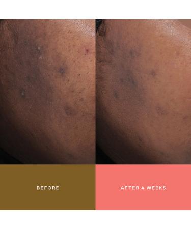 Shop EADEM Milk Marvel Dark Spot Serum with Niacinamide and Vitamin C - 1 oz/ 30 mL Online - Best Price & International Shipping - Buy Online on GoSupps.com
