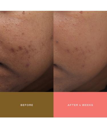 Shop EADEM Milk Marvel Dark Spot Serum with Niacinamide and Vitamin C - 1 oz/ 30 mL Online - Best Price & International Shipping - Buy Online on GoSupps.com