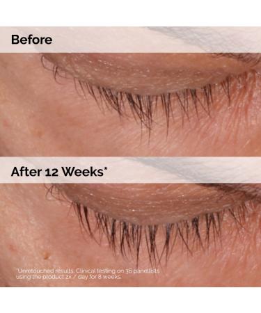 Shop The Ordinary Multi-Peptide Lash and Brow Serum Online - Best Price & International Shipping - Buy Online on GoSupps.com