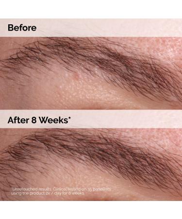 Shop The Ordinary Multi-Peptide Lash and Brow Serum Online - Best Price & International Shipping - Buy Online on GoSupps.com