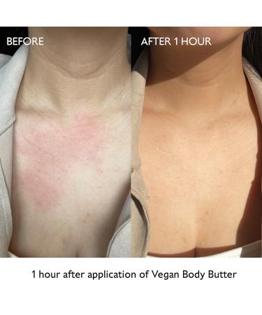 Shop Caudalie Moisturizing Vegan Body Butter - 8.4 oz/ 250 mL Online - Best Price & International Shipping - Buy Online on GoSupps.com
