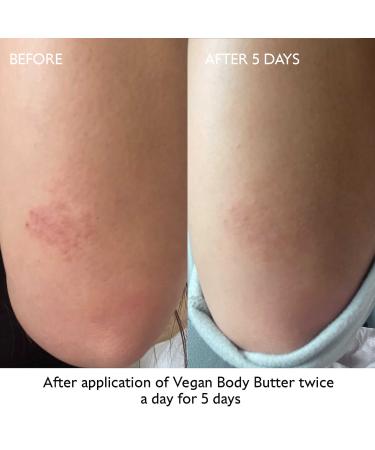 Shop Caudalie Moisturizing Vegan Body Butter - 8.4 oz/ 250 mL Online - Best Price & International Shipping - Buy Online on GoSupps.com