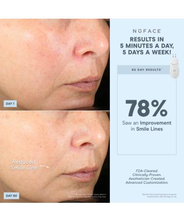 Shop NuFACE NuFACE Effective Lip & Eye Attachment Online - Best Price & International Shipping - Buy Online on GoSupps.com