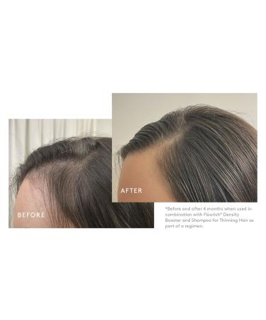 Shop Virtue Flourish Thickening Conditioner for Thinning Hair - 6.7 oz/ 200 mL Online - Best Price & International Shipping - Buy Online on GoSupps.com