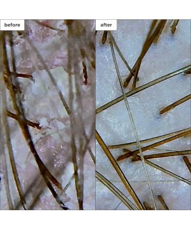 Shop Briogeo Scalp Revival Dandruff Relief Charcoal Shampoo - 8.4 oz/ 248 mL Online - Best Price & International Shipping - Buy Online on GoSupps.com