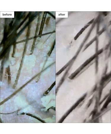 Shop Briogeo Scalp Revival Dandruff Relief Charcoal Shampoo - 8.4 oz/ 248 mL Online - Best Price & International Shipping - Buy Online on GoSupps.com