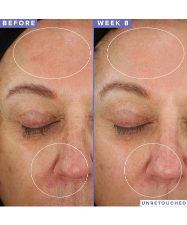 Shop Farmacy 10% Niacinamide Night Mask - 1.7 oz/ 50 mL Online - Best Price & International Shipping - Buy Online on GoSupps.com