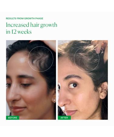 Shop The Nue Co. Growth Phase Hair Supplement - 90 Capsules Online - Best Price & International Shipping - Buy Online on GoSupps.com