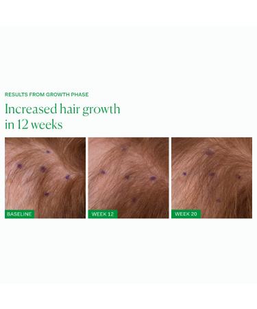 Shop The Nue Co. Growth Phase Hair Supplement - 90 Capsules Online - Best Price & International Shipping - Buy Online on GoSupps.com