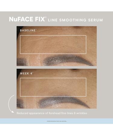 Shop NuFACE FIX Line Smoothing Device Online - Best Price & International Shipping - Buy Online on GoSupps.com