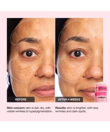 Shop iNNBEAUTY PROJECT 10 + 10 Moisturizer with 10% Vitamin C + 10% Peptide Complex + Ceramides - 1.7 oz/ 50 mL Online - Best Price & International Shipping - Buy Online on GoSupps.com