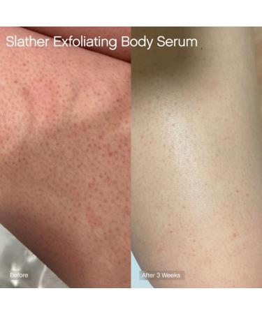 Shop Topicals Slather Exfoliating Body Serum with Retinol and AHAs - 5 oz / 150 mL Online - Best Price & International Shipping - Buy Online on GoSupps.com