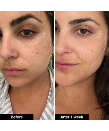 Shop iNNBEAUTY PROJECT Retinol Remix 1% Retinol Treatment With Peptide & Tranexamic Acid Online - Best Price & International Shipping - Buy Online on GoSupps.com