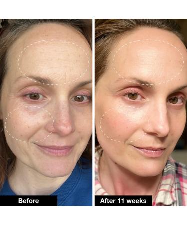 Shop iNNBEAUTY PROJECT Retinol Remix 1% Retinol Treatment With Peptide & Tranexamic Acid Online - Best Price & International Shipping - Buy Online on GoSupps.com