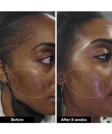 Shop iNNBEAUTY PROJECT Retinol Remix 1% Retinol Treatment With Peptide & Tranexamic Acid Online - Best Price & International Shipping - Buy Online on GoSupps.com