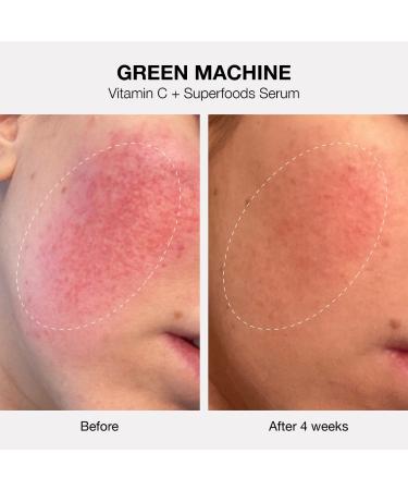 Shop iNNBEAUTY PROJECT The Healthy Skin Edit Bestsellers Kit Online - Best Price & International Shipping - Buy Online on GoSupps.com