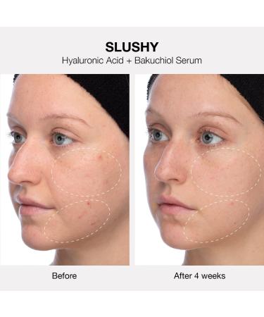 Shop iNNBEAUTY PROJECT The Healthy Skin Edit Bestsellers Kit Online - Best Price & International Shipping - Buy Online on GoSupps.com