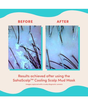 Shop Fable & Mane SahaScalp Scalp Reset Kit Online - Best Price & International Shipping - Buy Online on GoSupps.com