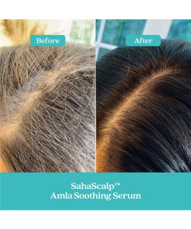 Shop Fable & Mane SahaScalp Scalp Reset Kit Online - Best Price & International Shipping - Buy Online on GoSupps.com