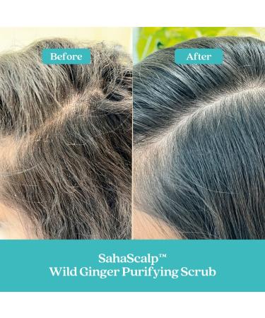 Shop Fable & Mane SahaScalp Scalp Reset Kit Online - Best Price & International Shipping - Buy Online on GoSupps.com