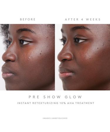 Shop Fenty Skin The Glow Around 4-Piece Travel Skincare Essentials Set Online - Best Price & International Shipping - Buy Online on GoSupps.com