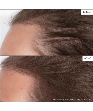 Shop Briogeo Destined for Density Peptide Hair Serum for Thicker Fuller Hair - 1.5 oz / 45 mL Online - Best Price & International Shipping - Buy Online on GoSupps.com