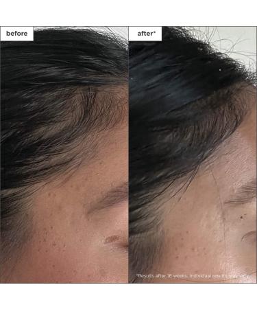 Shop Briogeo Destined for Density Peptide Hair Serum for Thicker Fuller Hair - 1.5 oz / 45 mL Online - Best Price & International Shipping - Buy Online on GoSupps.com