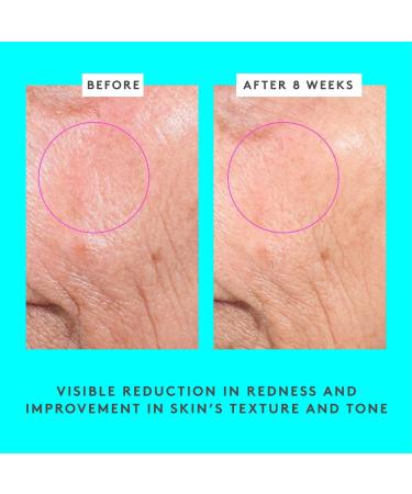 Shop Drunk Elephant Bouncy Brightfacial Brightening Mask with 10% Azelaic Acid + 1% Salicylic Acid - 1.69 oz / 50 mL Online - Best Price & International Shipping - Buy Online on GoSupps.com