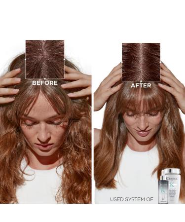 Shop K rastase Symbiose Exfoliating Antidandruff Scalp Scrub - 6.8 oz / 200 mL Online - Best Price & International Shipping - Buy Online on GoSupps.com