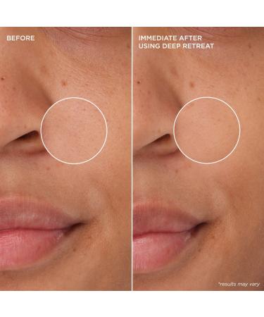 Shop Benefit Cosmetics The POREfessional Deep Retreat Pore-Clearing Kaolin Clay Mask - 2.5 oz / 75 mL Online - Best Price & International Shipping - Buy Online on GoSupps.com