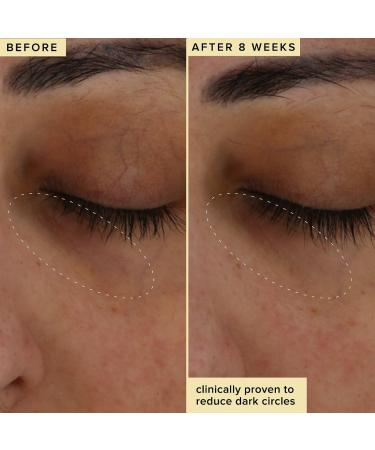 Shop Farmacy Wake Up Honey Eye Cream with Brightening Vitamin C - 0.5 oz / 15 mL Online - Best Price & International Shipping - Buy Online on GoSupps.com