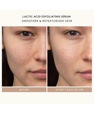 Shop Shani Darden Skin Care It All Starts with Retinol: Shani s Starter Set 	 Online - Best Price & International Shipping - Buy Online on GoSupps.com