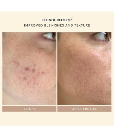 Shop Shani Darden Skin Care It All Starts with Retinol: Shani s Starter Set 	 Online - Best Price & International Shipping - Buy Online on GoSupps.com