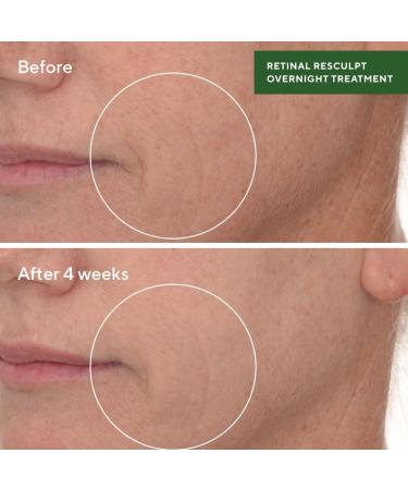 Shop Murad Retinal ReSculpt Overnight Treatment - 1 oz / 30 mL Online - Best Price & International Shipping - Buy Online on GoSupps.com