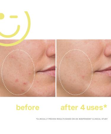 Shop Kate Somerville MEGA-C 30% Vitamin C Brightening Mask - 2 oz / 60 mL Online - Best Price & International Shipping - Buy Online on GoSupps.com