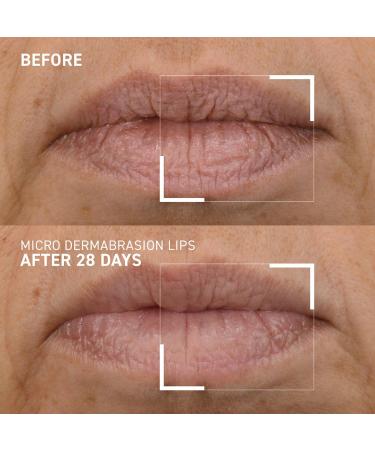 Shop Dr. Brandt Skincare Microdermabrasion Smoothing Lip Scrub - 0.35 oz / 10 mL Online - Best Price & International Shipping - Buy Online on GoSupps.com