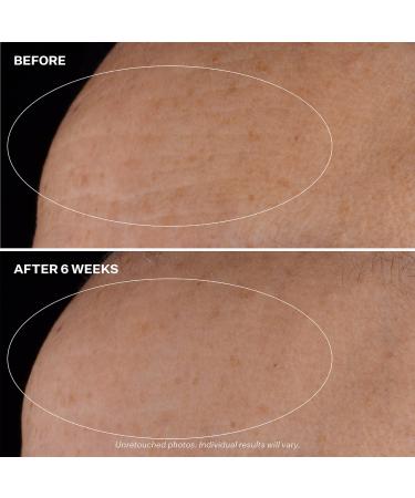 Shop StriVectin Advanced Retinol Nightly Multi Correct Serum - 1 oz / 30 mL Online - Best Price & International Shipping - Buy Online on GoSupps.com